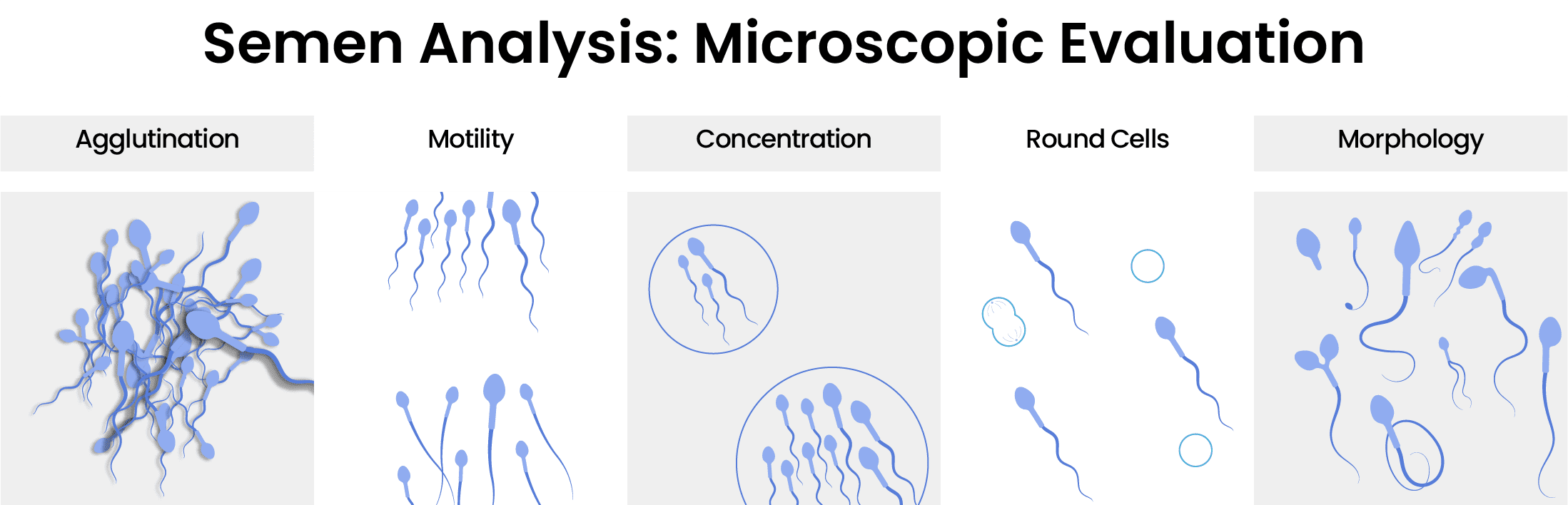 Semen-Analysis-Microscopic-Evaluation