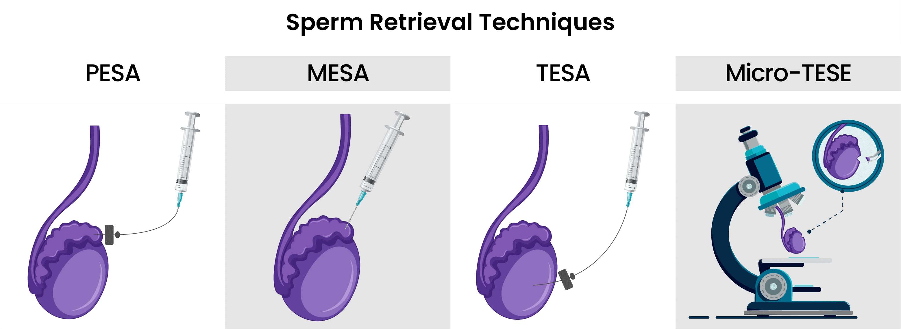 Sperm-Retrieval-Techniques