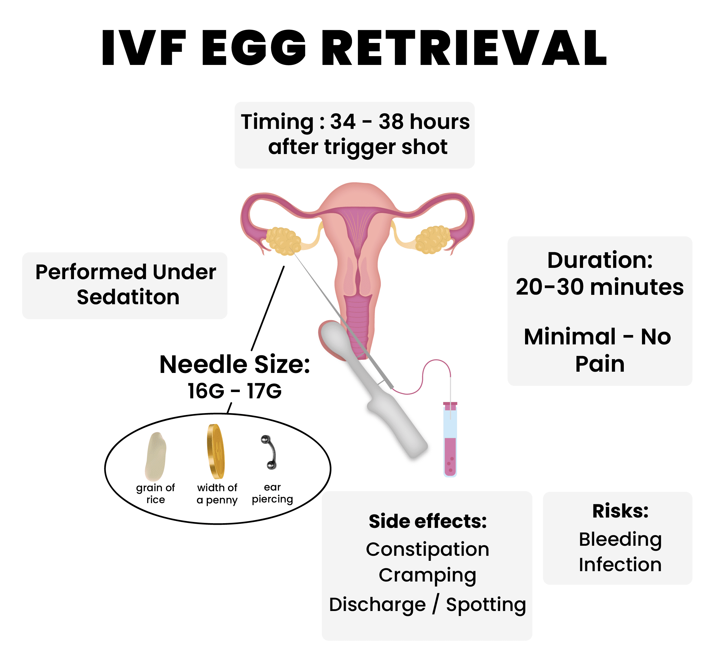 ivf-egg-retrieval